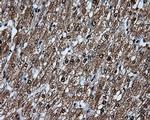 KIAA1609 Antibody in Immunohistochemistry (Paraffin) (IHC (P))