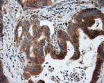 KIAA1609 Antibody in Immunohistochemistry (Paraffin) (IHC (P))