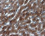 KIAA1609 Antibody in Immunohistochemistry (Paraffin) (IHC (P))