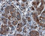 KIAA1609 Antibody in Immunohistochemistry (Paraffin) (IHC (P))