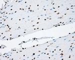KIAA1609 Antibody in Immunohistochemistry (Paraffin) (IHC (P))