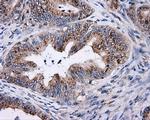 KIAA1609 Antibody in Immunohistochemistry (Paraffin) (IHC (P))