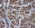 KIAA1609 Antibody in Immunohistochemistry (Paraffin) (IHC (P))