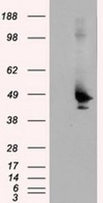 KIAA1609 Antibody in Western Blot (WB)