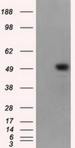KIAA1609 Antibody in Western Blot (WB)