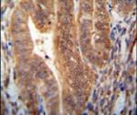 KIAA1644 Antibody in Immunohistochemistry (IHC)