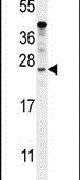 KIAA1644 Antibody in Western Blot (WB)