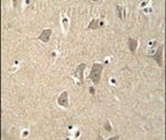 KIAA1680 Antibody in Immunohistochemistry (IHC)