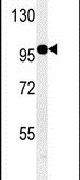 KIAA1688 Antibody in Western Blot (WB)