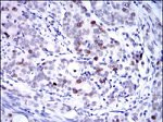 KID Monoclonal Antibody (5F3)