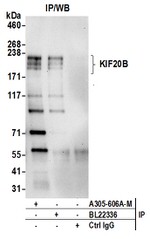 KIF20B Polyclonal Antibody