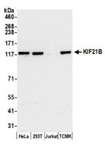 KIF21B Antibody in Western Blot (WB)