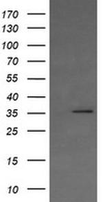 KIF25 Antibody in Western Blot (WB)