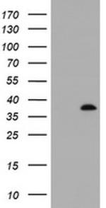 KIF25 Antibody in Western Blot (WB)