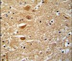 KIF3C Antibody in Immunohistochemistry (IHC)