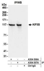 KIF5B Antibody in Western Blot (WB)