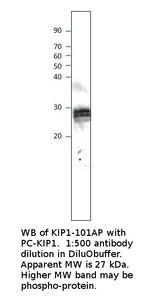 p27 KIP1 Polyclonal Antibody
