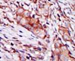 KIP2 Antibody in Immunohistochemistry (IHC)