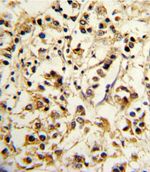 KIR2DL4 Antibody in Immunohistochemistry (IHC)