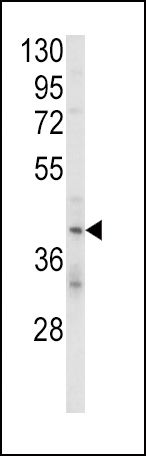 KIR2DL4 Antibody in Western Blot (WB)