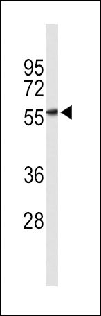 KIR3DL2 Antibody in Western Blot (WB)
