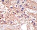 UHMK1 Antibody in Immunohistochemistry (IHC)