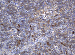 KIT Antibody in Immunohistochemistry (Paraffin) (IHC (P))