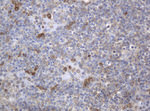 KIT Antibody in Immunohistochemistry (Paraffin) (IHC (P))