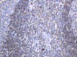 KIT Antibody in Immunohistochemistry (Paraffin) (IHC (P))