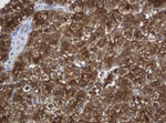 KIT Antibody in Immunohistochemistry (Paraffin) (IHC (P))