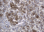 KIT Antibody in Immunohistochemistry (Paraffin) (IHC (P))