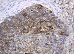 KIT Antibody in Immunohistochemistry (Paraffin) (IHC (P))