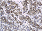 KIT Antibody in Immunohistochemistry (Paraffin) (IHC (P))
