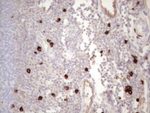 KIT Antibody in Immunohistochemistry (Paraffin) (IHC (P))