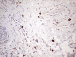 KIT Antibody in Immunohistochemistry (Paraffin) (IHC (P))