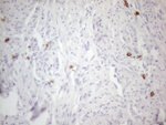 KIT Antibody in Immunohistochemistry (Paraffin) (IHC (P))