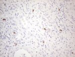 KIT Antibody in Immunohistochemistry (Paraffin) (IHC (P))