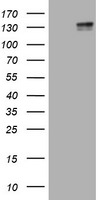 KIT Antibody in Western Blot (WB)
