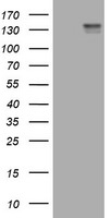 KIT Antibody in Western Blot (WB)