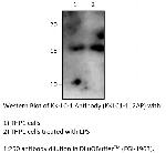 KK-LC-1 Polyclonal Antibody