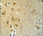 KLC2 Antibody in Immunohistochemistry (IHC)