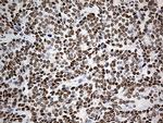 KLF11 Antibody in Immunohistochemistry (Paraffin) (IHC (P))