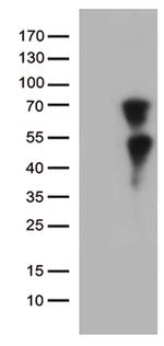 KLF11 Antibody in Western Blot (WB)