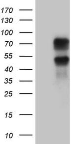 KLF11 Antibody in Western Blot (WB)