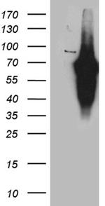 KLF11 Antibody in Western Blot (WB)