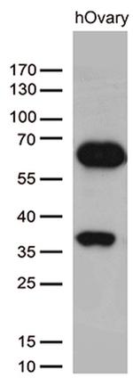 KLF11 Antibody in Western Blot (WB)