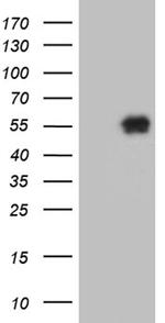 KLF12 Antibody in Western Blot (WB)