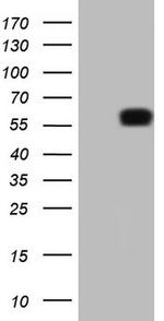 KLF2 Antibody in Western Blot (WB)