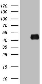KLF2 Antibody in Western Blot (WB)