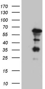 KLF5 Antibody in Western Blot (WB)